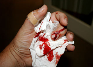 Box cutter versus thumb